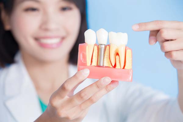 What Foods Are Friendly To Dental Implants?