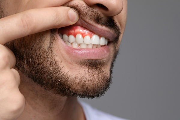 How A Family Dentist Provides Gum Disease Treatment